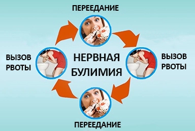 Лечение булимии в Волоколамске